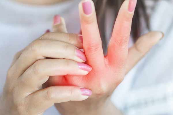 information of Scabies