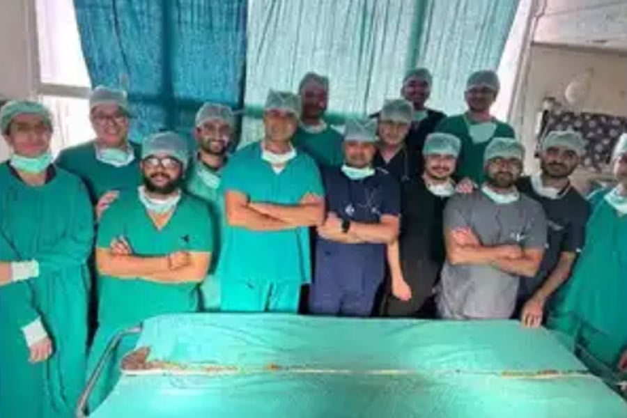 Jaipur doctors removed the world longest hairball from teen girl's stomach