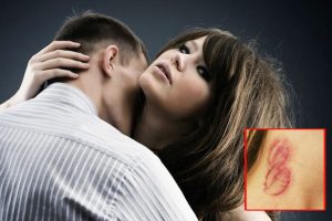 Can 'love bites' cause sexually transmitted diseases