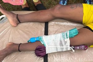 Railway FC footballer Tarak Hembram get release from Hospital