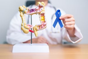 Colon cancer is increasing among young people, doc warn of 5 signs