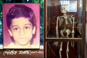 Corpse of 5 year old Shouvik is used in medical college lessons