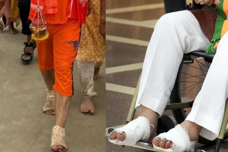 BJP leader Manoj Tiwari on wheel chair after Kanwar Yatra