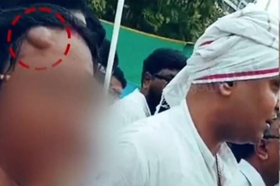 Nabanna Abhijan: Many questions arise regarding injury of Abhaya's mother, What Kolkata Police says