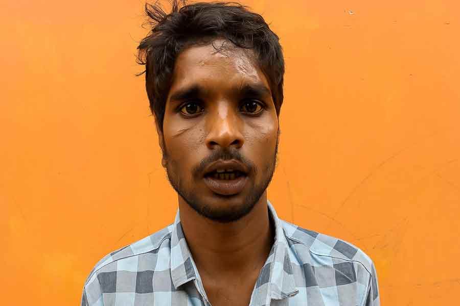 Birbhum youth's ear allegedly chopped off in Mumbai