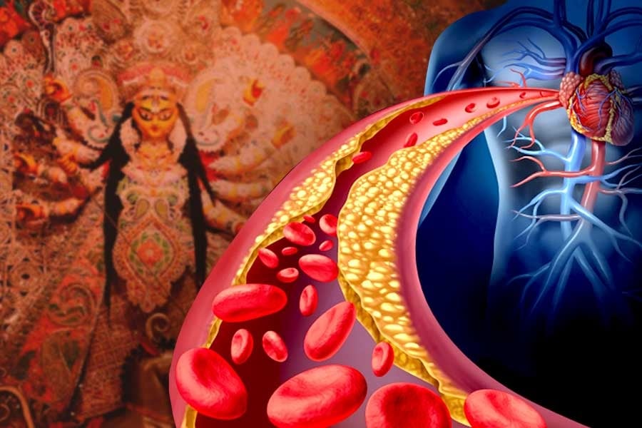 Prescription Plus: Follow these tips to keep your cholesterol under control