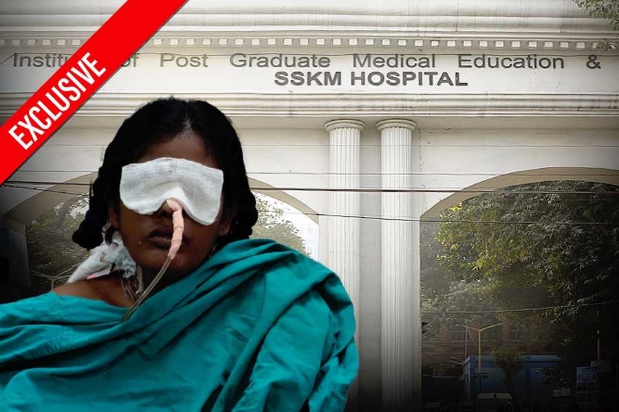 SSKM Hospital | Gastroenterosurgeons create history after operating on the world's largest resected pancreatic head tumor in Kolkata