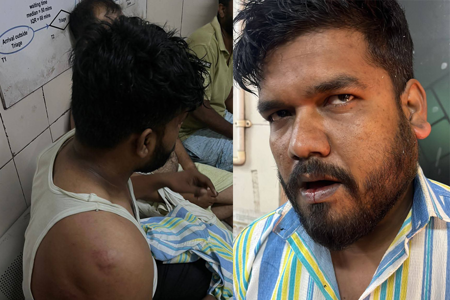 2 families clash in Asansol over firecracker burning