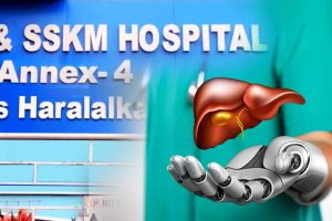 Robot did gallbladder surgery at SSKM Hospital