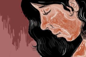 acid attack on school student at basirhat