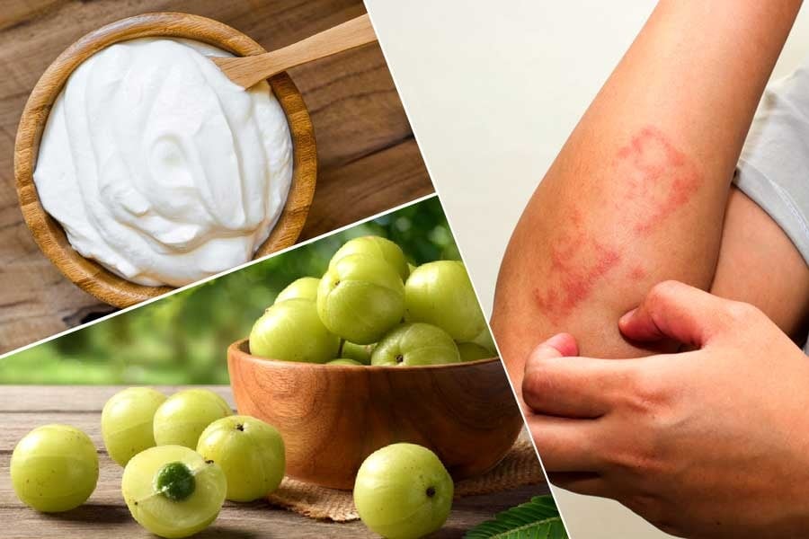 Keep these 5 foods in your diet to stay away from allergies