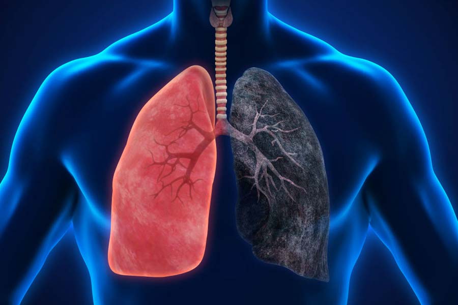 How to remove toxins from the lungs after quitting smoking