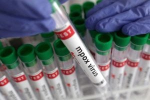 'MPox' strain is spreading in US around the world, doctors are worried about a new scare